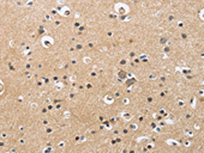 CKMT2 Antibody