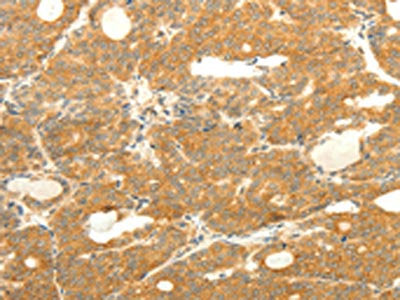SOX2 Antibody