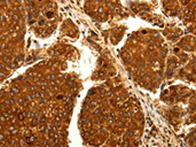 MAP1LC3A Antibody