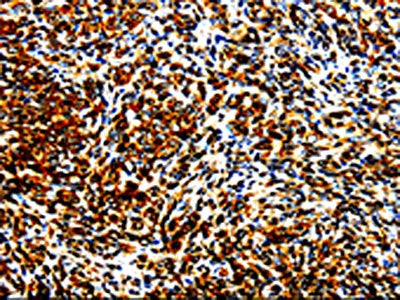 STAT5B Antibody