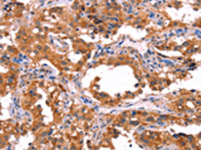 ERAS Antibody