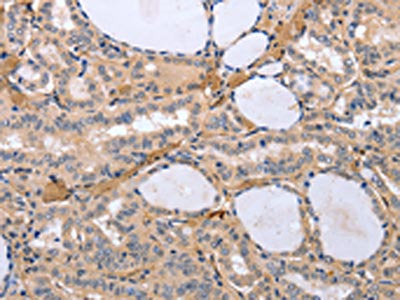TYROBP Antibody