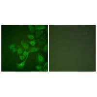TIMP2 Antibody