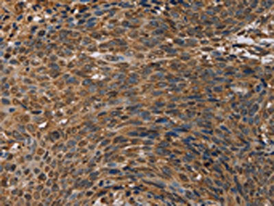 HIF1AN Antibody