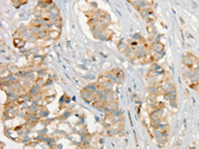 MMP9 Antibody