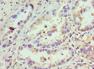 CDCA8 Antibody