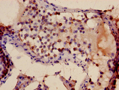 TFDP3 Antibody