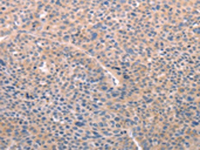 A4GNT Antibody