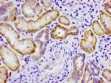 CRTC2 Antibody