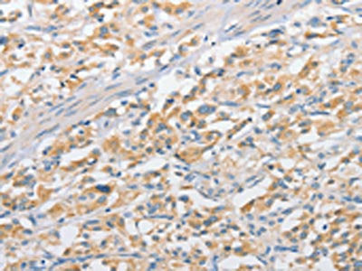 APPBP2 Antibody