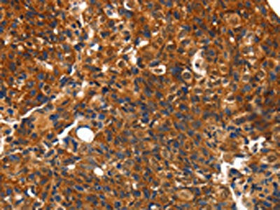 CMTM3 Antibody