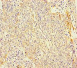 PAGE2B Antibody