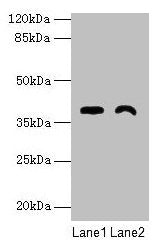 TMEM255A Antibody