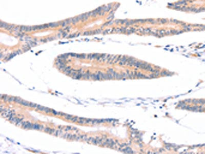 ADAP1 Antibody