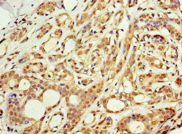 ACSM3 Antibody