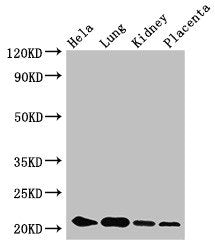KRBOX4 Antibody