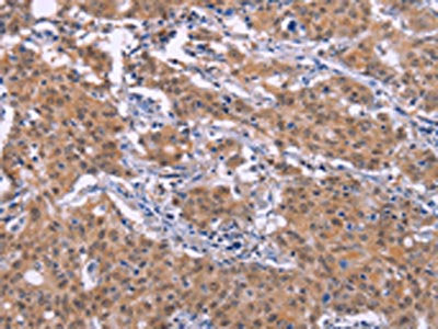EP300 Antibody