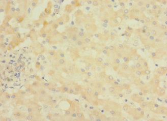 ASPHD1 Antibody