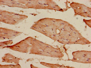 CDKAL1 Antibody