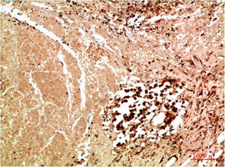 MAPK10 Antibody