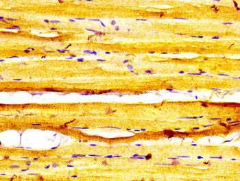 MYBPC1 Antibody