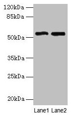 STEAP3 Antibody