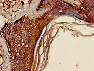 KDM4D Antibody