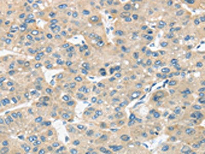 TIRAP Antibody