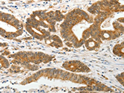 SLC12A1 Antibody