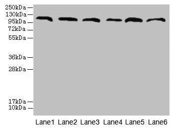 CATSPERE Antibody
