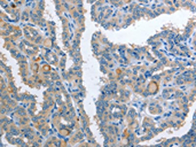 AP2S1 Antibody