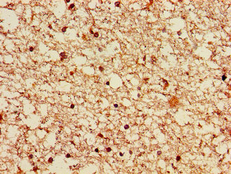 LRRK2 Antibody