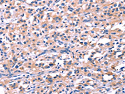 FEM1B Antibody
