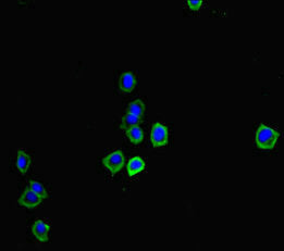 Osm Antibody