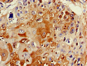 TTC19 Antibody