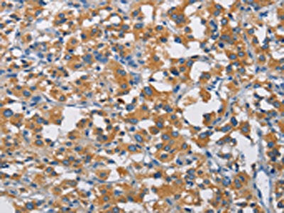 CRTAM Antibody