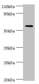 ACBD5 Antibody