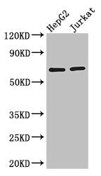 RUNX1T1 Antibody