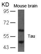 MAPT (Ab-396) Antibody