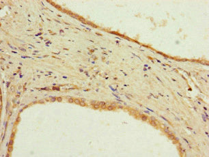PPP2R2D Antibody
