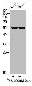 Acetyl-HNF4A (Lys106) Antibody