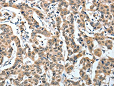 IL1R1 Antibody