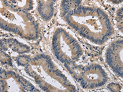 KCND1 Antibody
