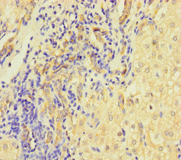 L1TD1 Antibody