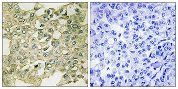 Phospho-PKMYT1 (Ser83) Antibody