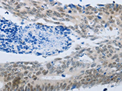 MMP21 Antibody