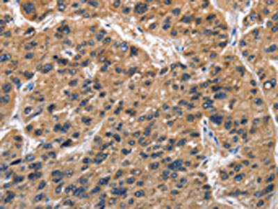 ABI3BP Antibody