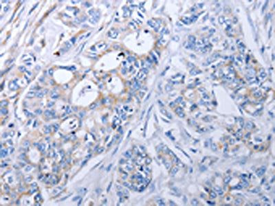 ALDH1A1/ALDH1A2/ALDH1A3 Antibody