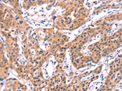SERPINA5 Antibody