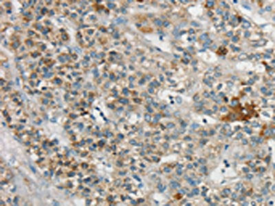 SYCP3 Antibody